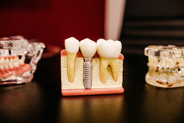 Ilustrasi pemeriksaan gigi di klinik gigi jakarta